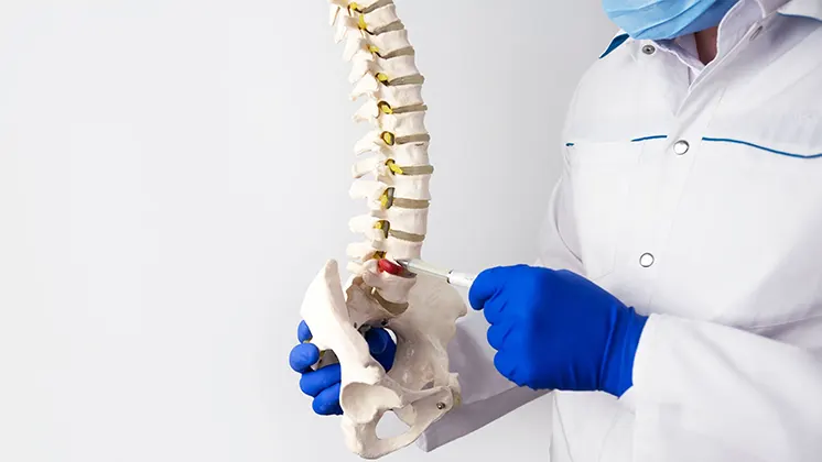 Herniated Disc Workers’ Compensation Settlements In Virginia
